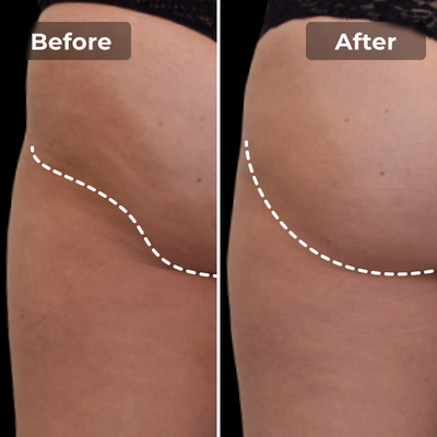 BootyBoost EMS-Shorts