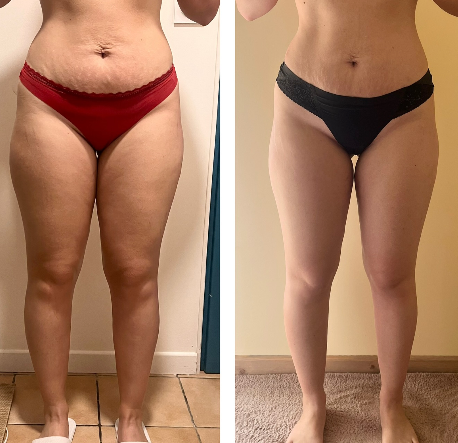 Lymvita™ Flüssige Lymphdrainage – Verfeinertes Gesicht, leichte Beine, flacher Bauch