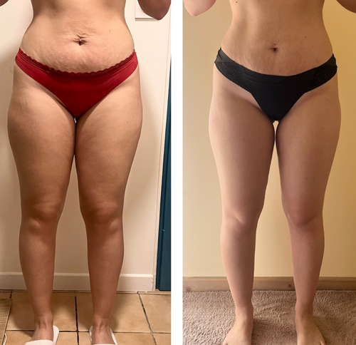 Lymvita™ Flüssige Lymphdrainage – Verfeinertes Gesicht, leichte Beine, flacher Bauch