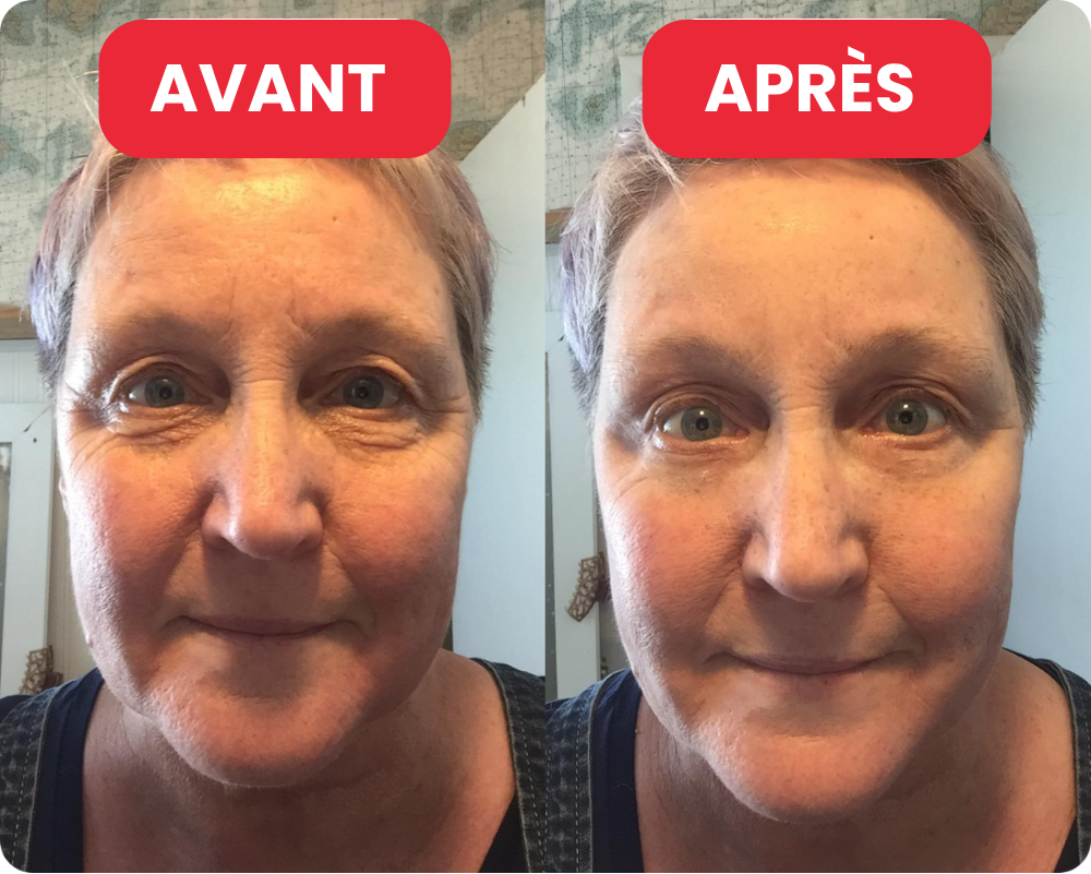 Lumévia™ Madeca Crème Anti-Âge Total