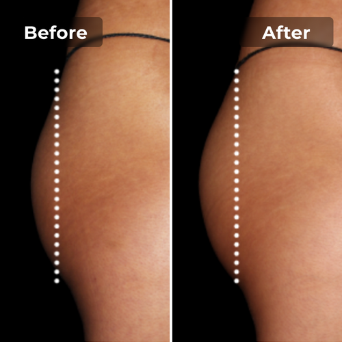 BootyBoost EMS-Shorts