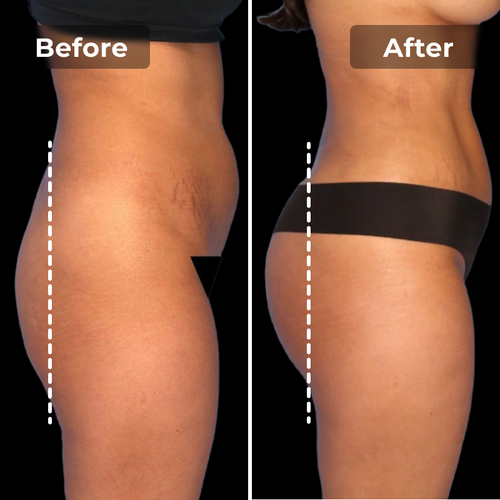 BootyBoost EMS-Shorts