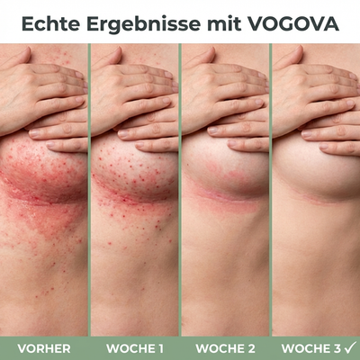 Hautwolf Linderungscreme